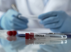 RD Congo N&uacute;mero de mortes por surto de Ebola aumenta, com 131 v&iacute;timas j&aacute; registradas